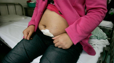 pregnant girl