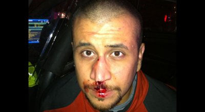 George Zimmerman